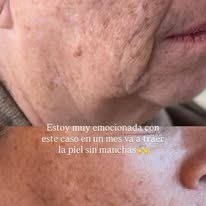 Consejos para piel sensible